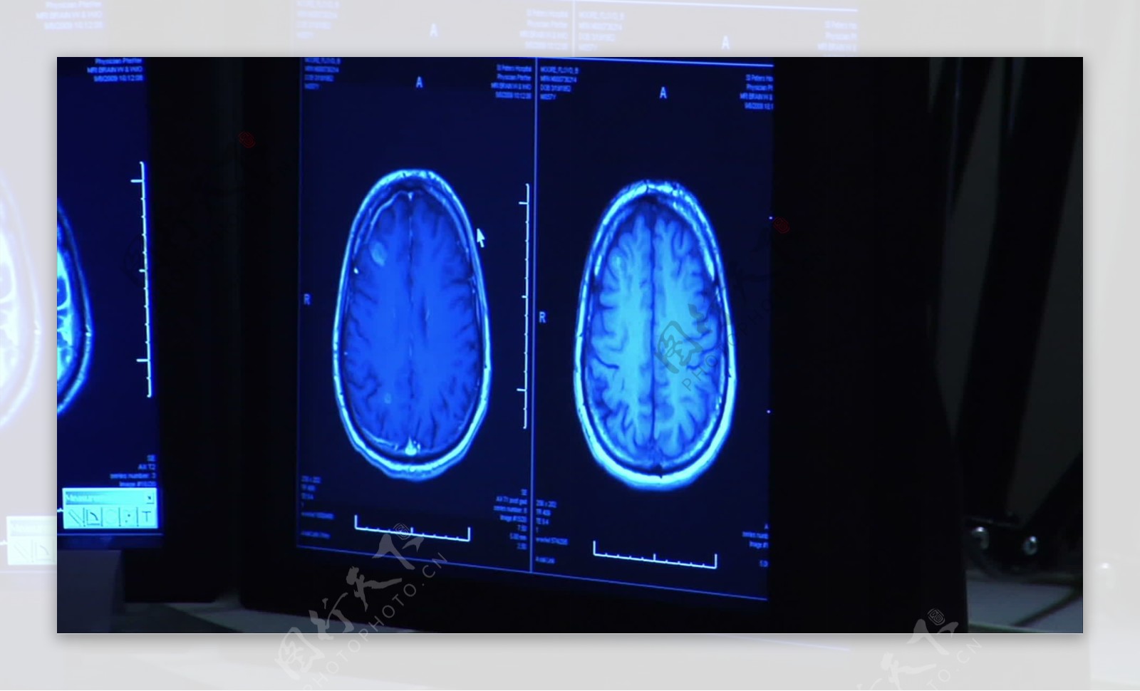 放射科医生看监控录像脑扫描的股票视频免费下载