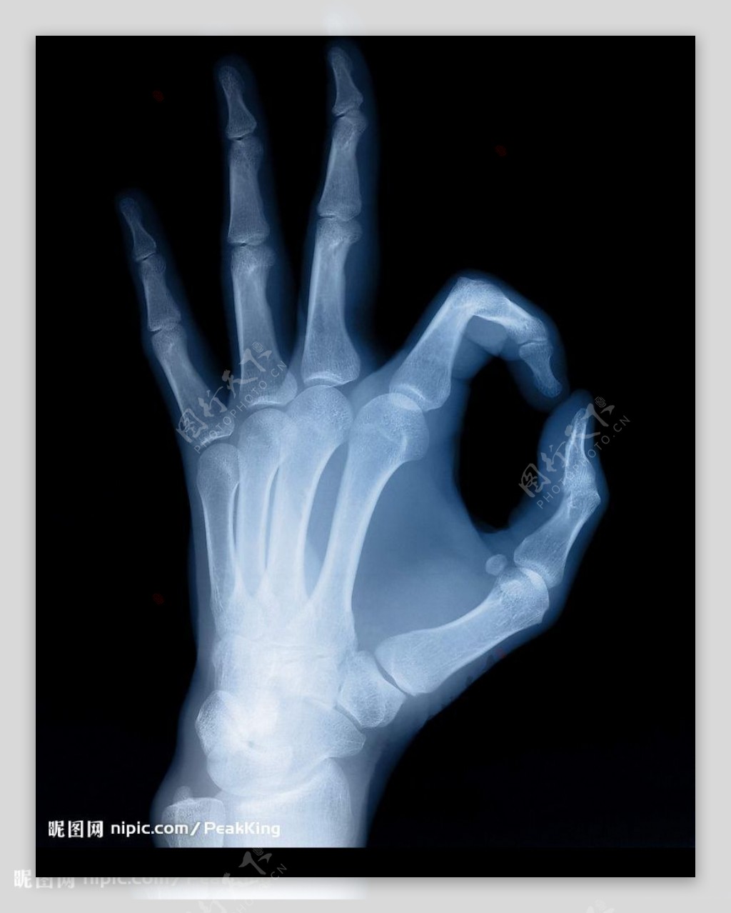 手的X光照片图片
