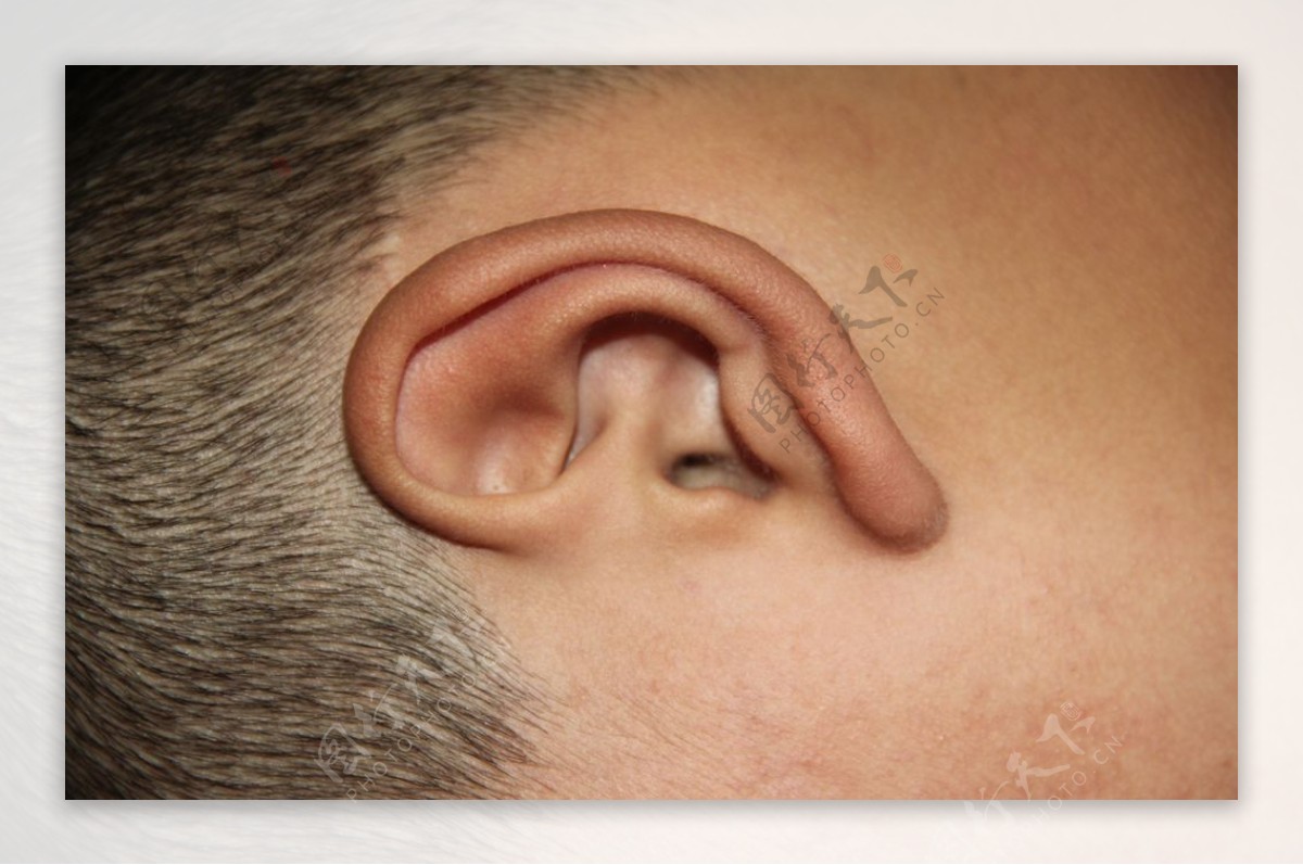 耳朵图片