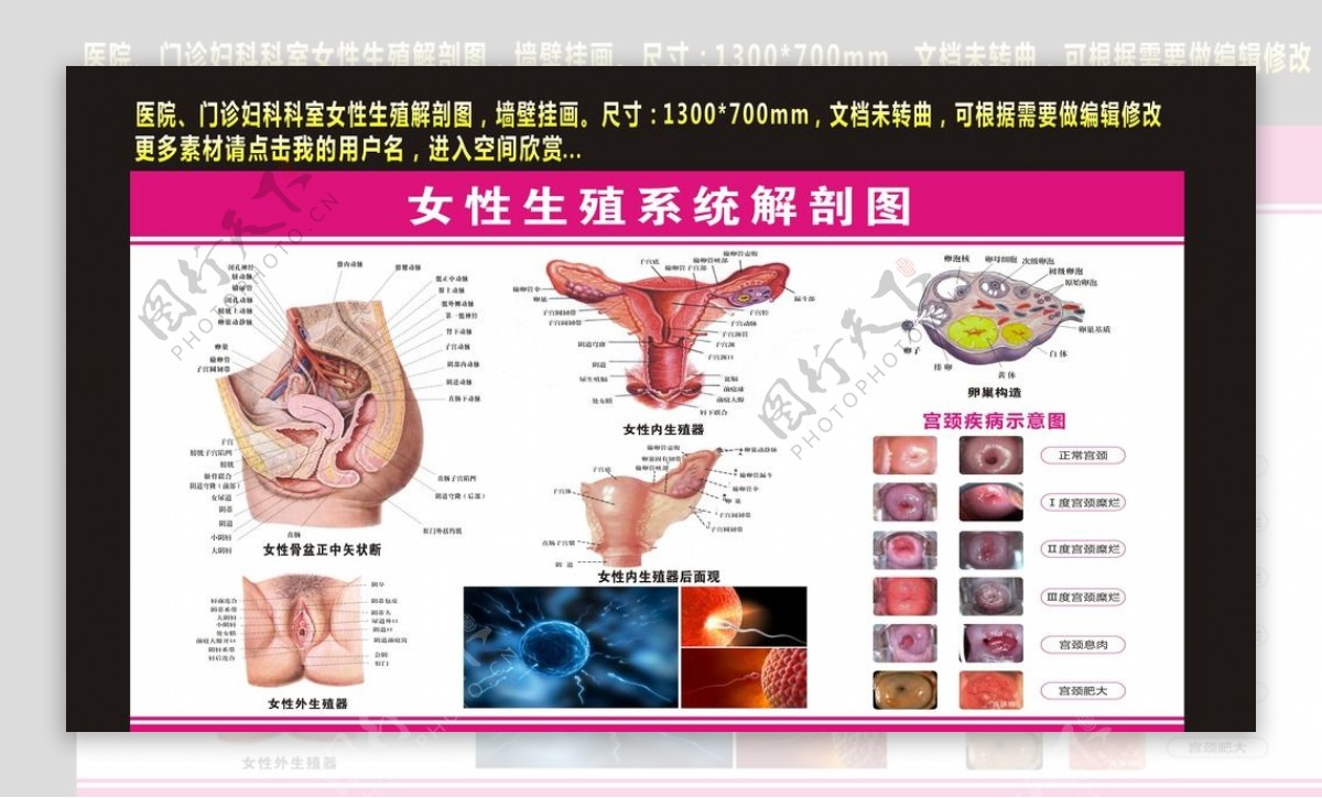 女性生殖系统解剖图图图片