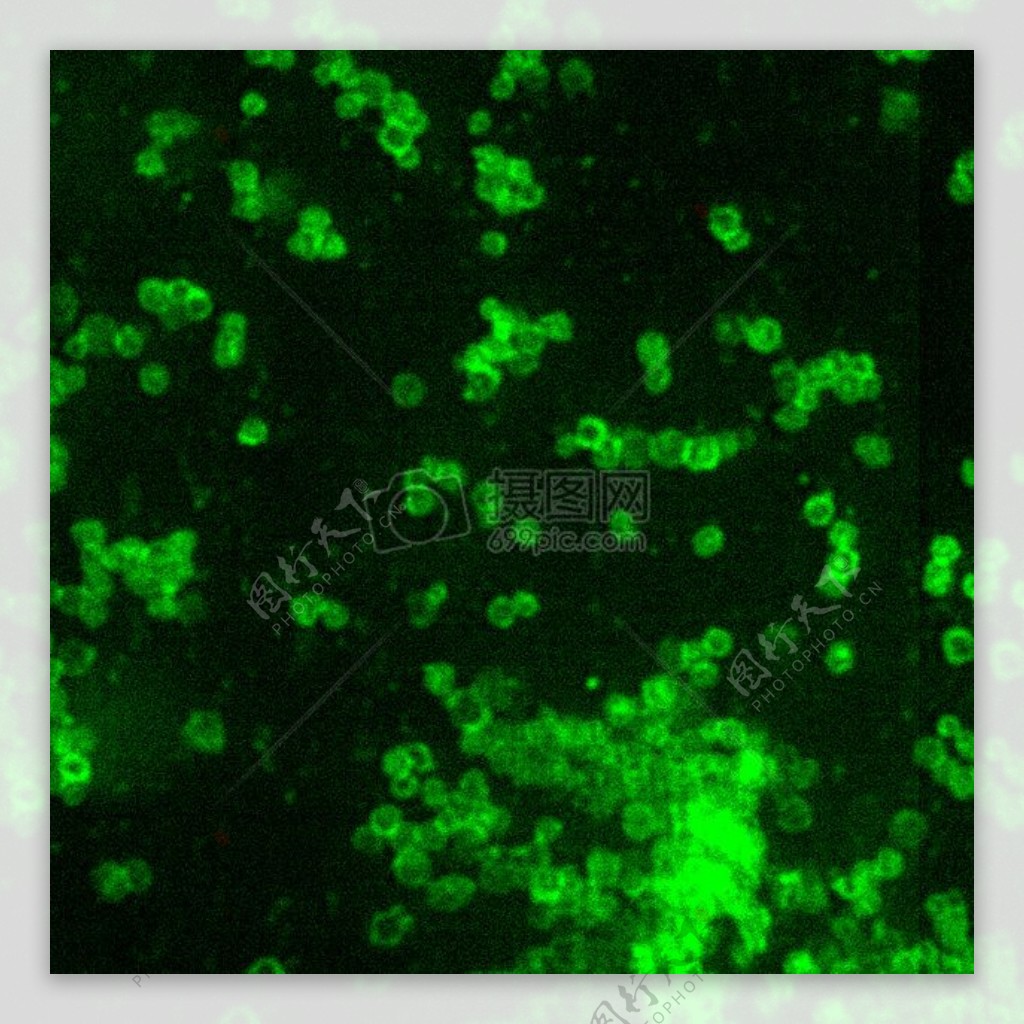土拉弗朗西斯菌所看到与直接荧光抗体染色DFA