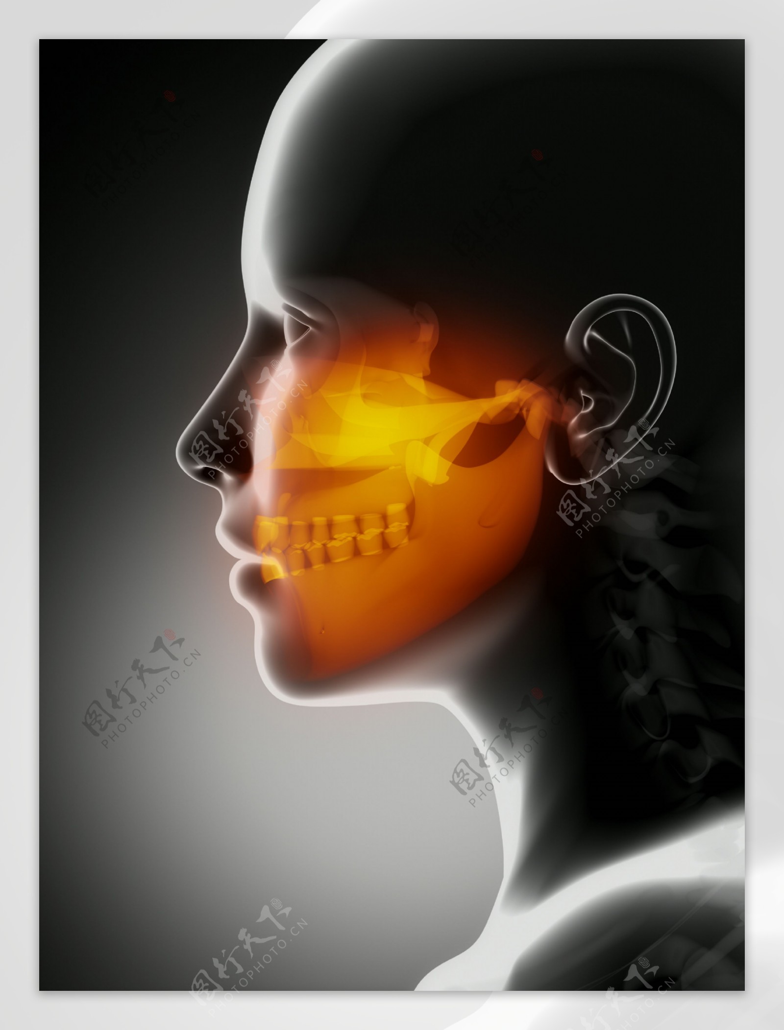 人体头骨CT图片