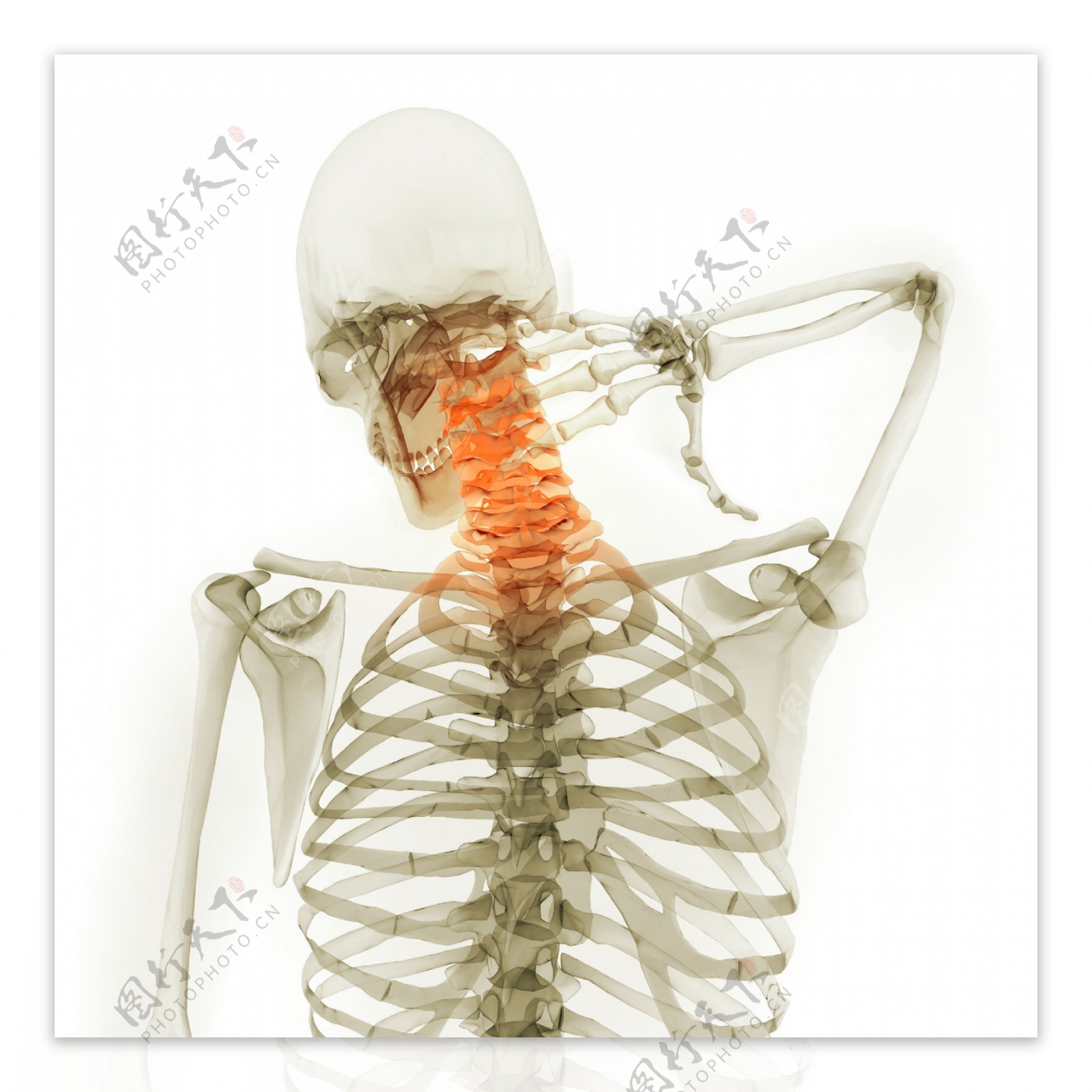 人体脊椎X光图像图片